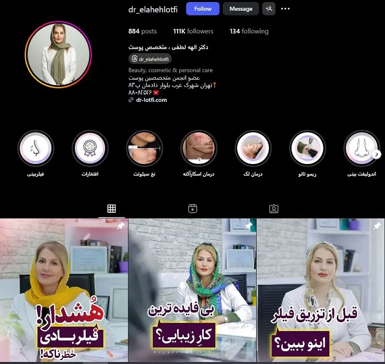 دکتر الهه لطفی، تزریق ژل لب در تهران