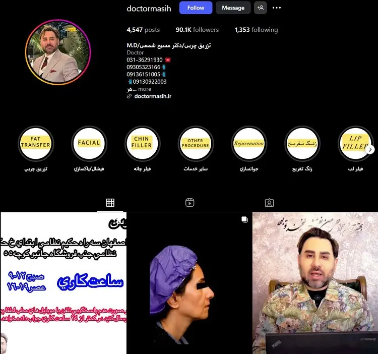 دکتر تزریق بوتاکس مسیح شمعی