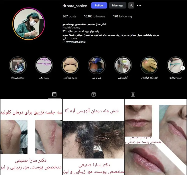 دکتر سارا صنیعی، تزریق بوتاکس در تبریز