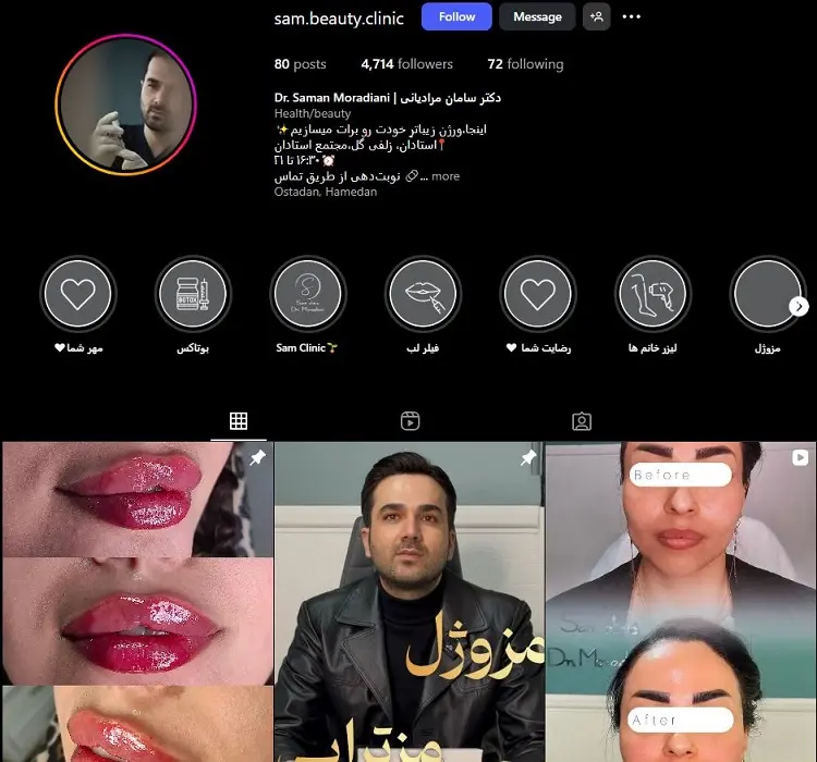 دکتر بوتاکس سامان مرادیانی همدان