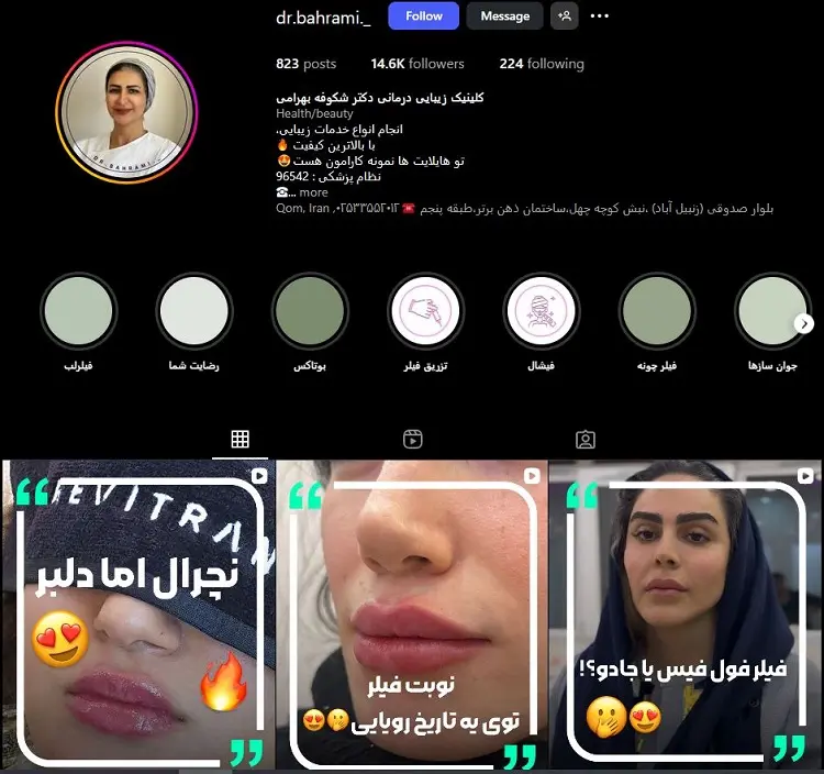 دکتر تزریق بوتاکس شکوفه بهرامی قم