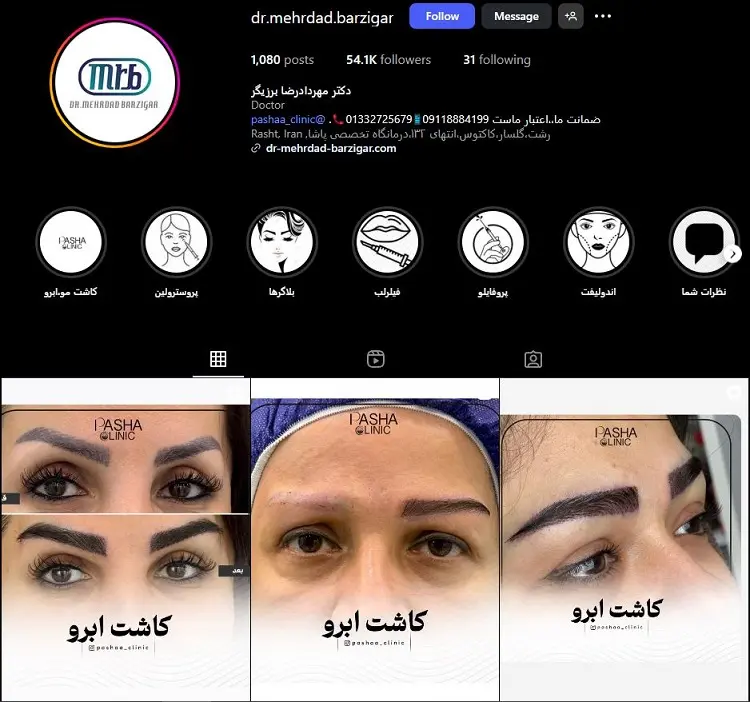دکتر مهرداد برزیگر، بوتاکس در رشت