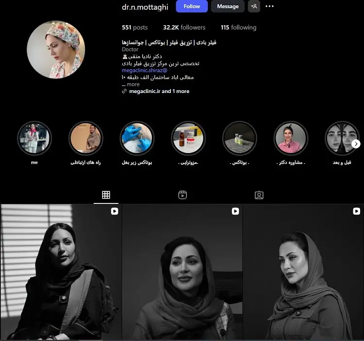 دکتر تزریق بوتاکس نادیا متقی