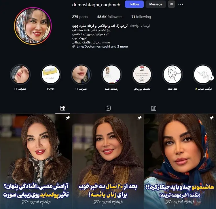 دکتر نغمه مشتاقی، تزریق بوتاکس در تهران