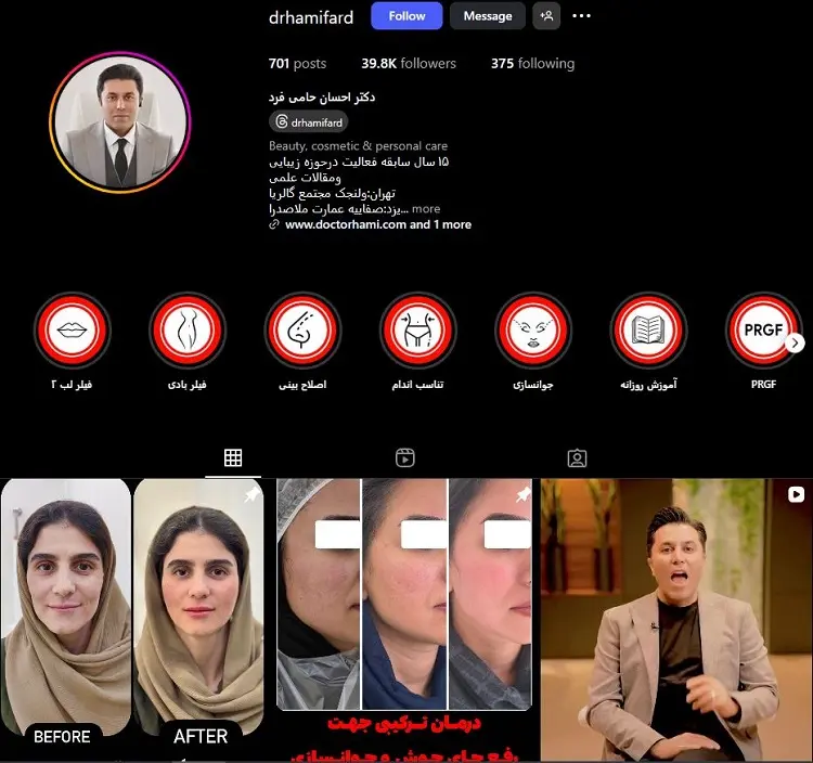 دکتر بوتاکس احسان حامی فرد