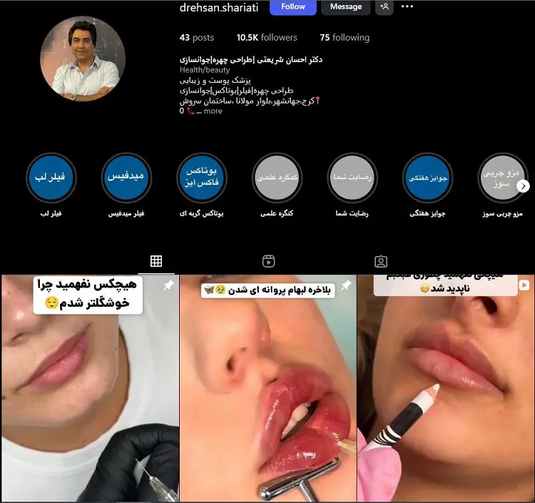 دکتر تزریق ژل لب احسان شریعتی کرج