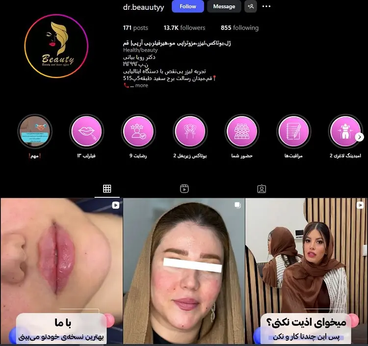 دکتر رویا بیاتی، بهترین دکتر تزریق ژل لب در قم
