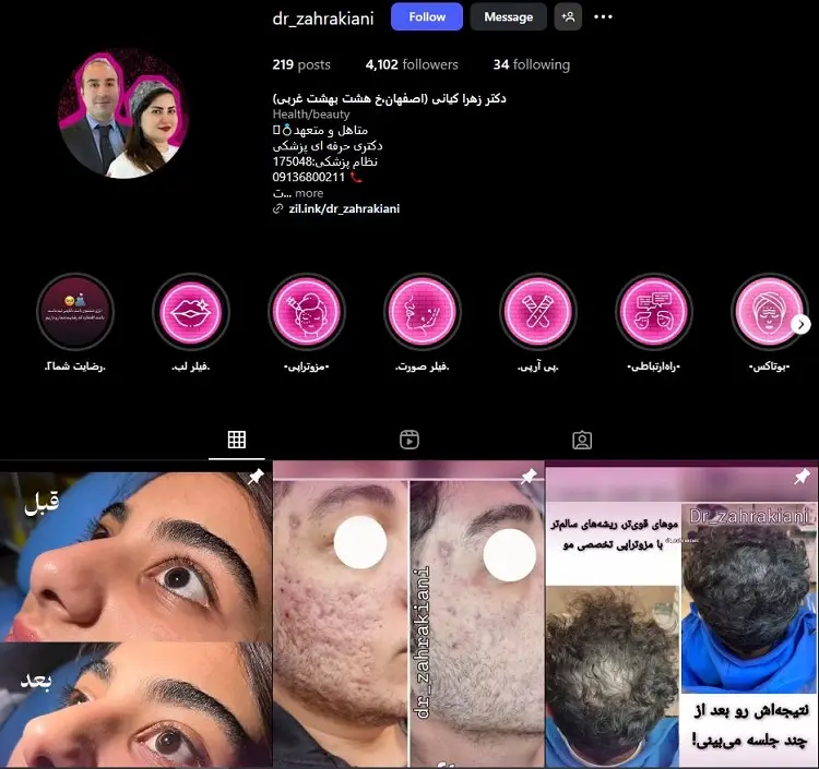 دکتر زهرا کیانی، تزریق ژل لب در اصفهان
