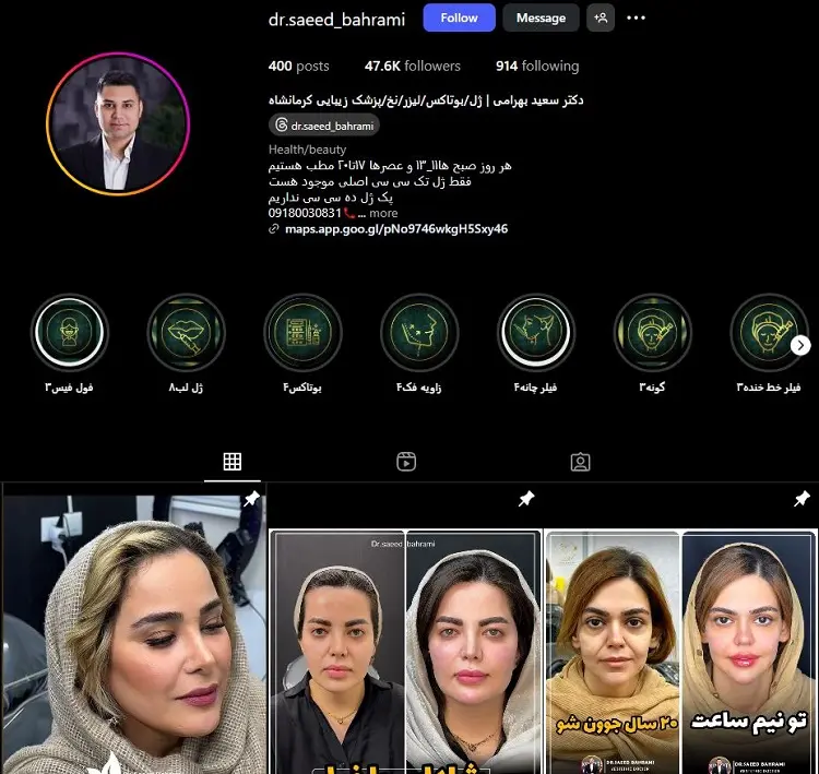 دکتر تزریق ژل لب سعید بهرامی کرمانشاه