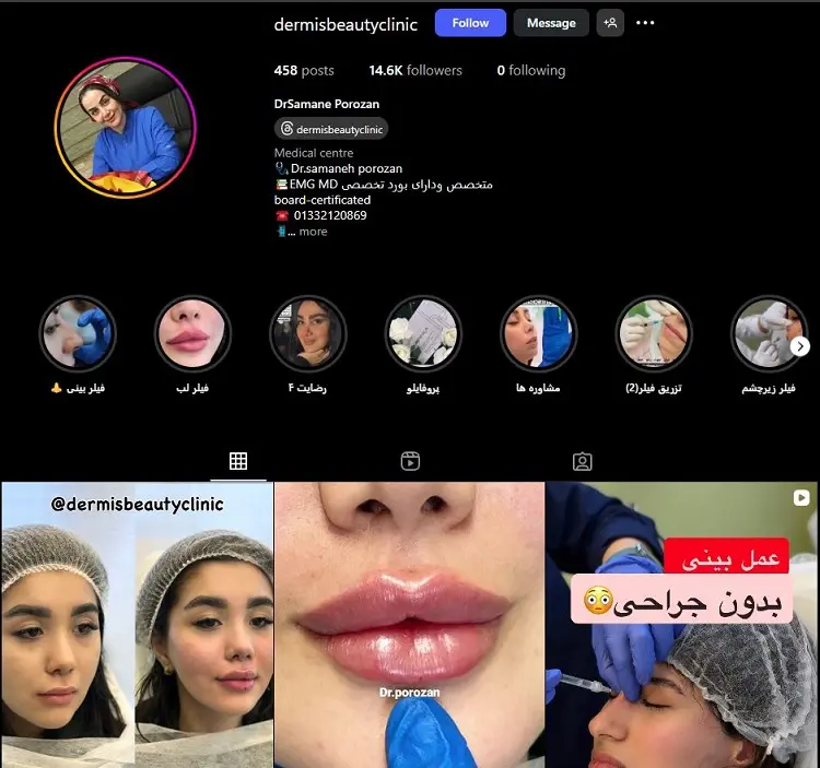 دکتر تزریق ژل لب سمانه رشت