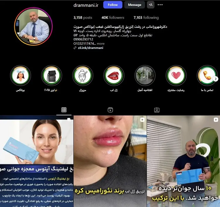 دکتر شهروز امانی، تزریق ژل لب در رشت