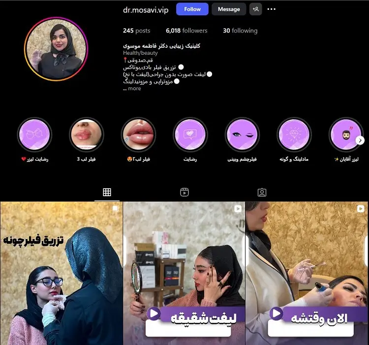 دکتر تزریق ژل لب فاطمه موسوی قم