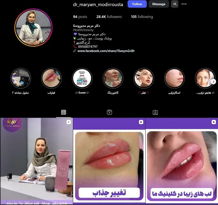 دکتر مریم مدیر روستا، بهترین دکتر تزریق ژلب لب کرج
