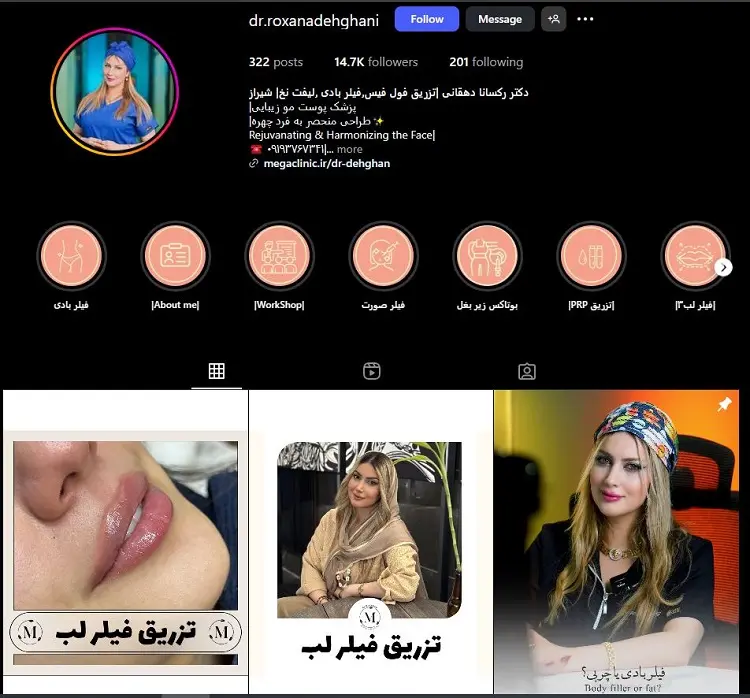 دکتر رکسانا دهقانی، دکتر باتجربه تزریق فیلر لب شیراز