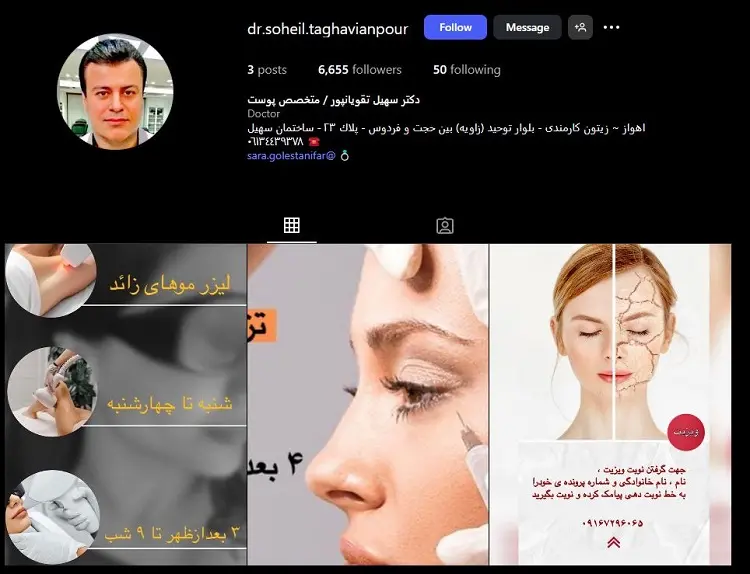 تزریق بوتاکس دکتر سهیل تقویان پور اهواز