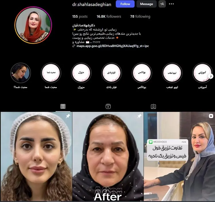 دکتر بوتاکس شهلا صادقیان