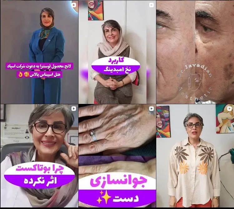 دکتر شهناز جوادیان، تزریق بوتاکس در کرج