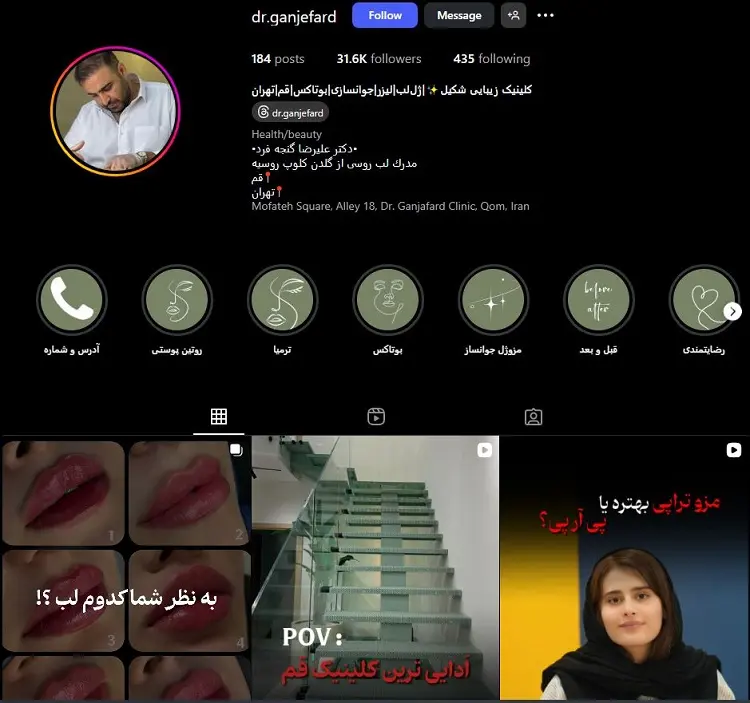 دکتر تزریق ژل لب علیرضا گنجه فرد