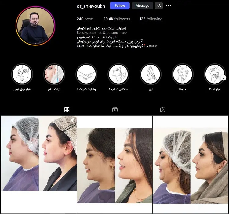 کلینیک تزریق ژل لب دکتر محمدهاشم شیوخ کرمان