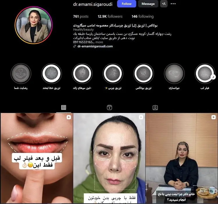 دکتر معصومه امامی سیگارودی، تزریق بوتاکس رشت