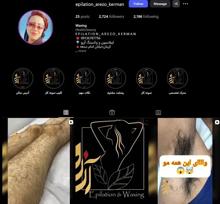 سالن اپیلاسیون آرزو