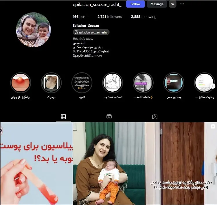 سالن اپیلاسیون سوزان در رشت