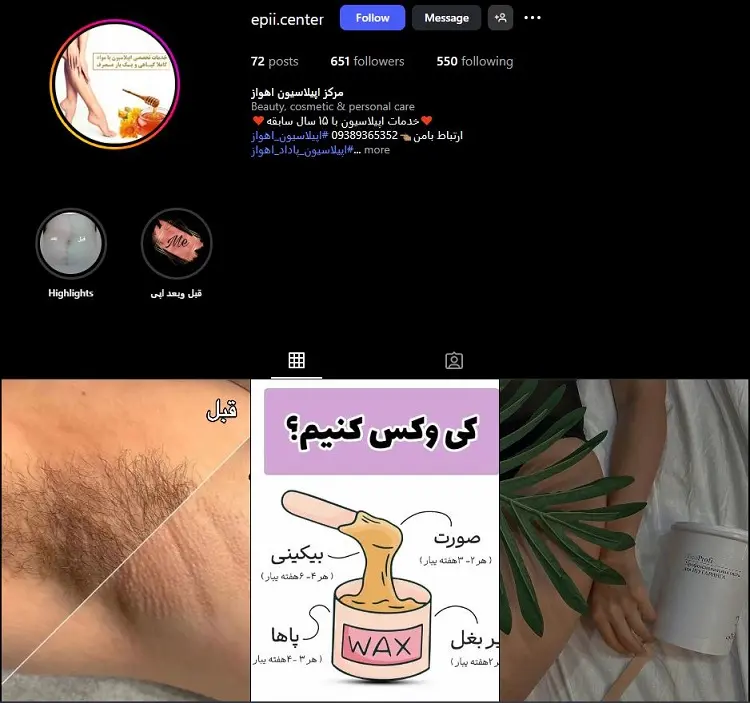 مرکز اپیلاسیون اهواز
