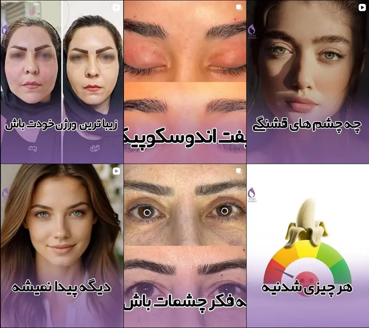کلینیک بوتاکس عظیمیه