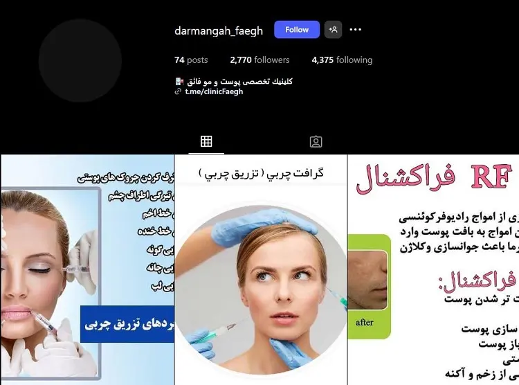 کلینیک تزریق بوتاکس فائق تبریز