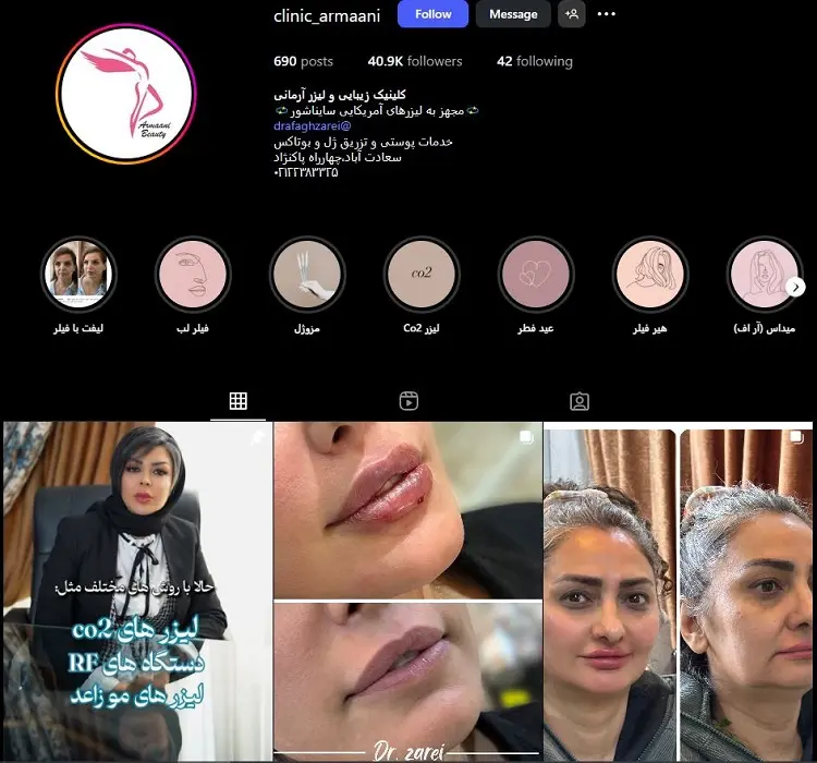 کلینیک آرمانی، بهترین کلینیک تزریق ژل لب در تهران