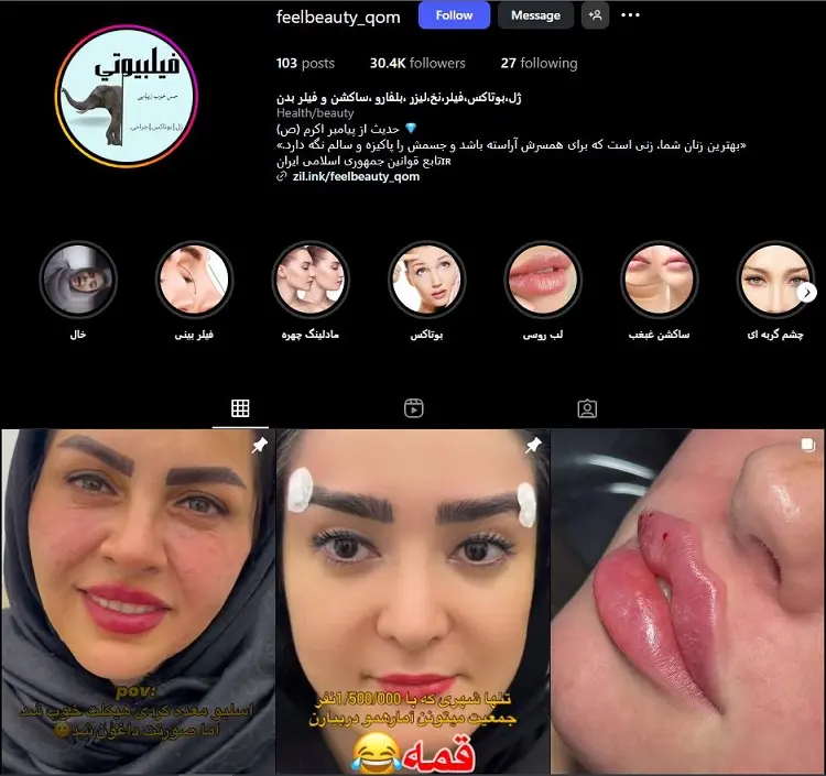 کلینیک تزریق ژل لب فیلبیوتی قم