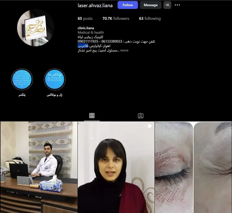 کلینیک تزریق ژل لب لیانا اهواز