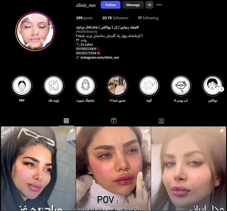 کلینیک تزریق ژل لب نور کرمانشاه