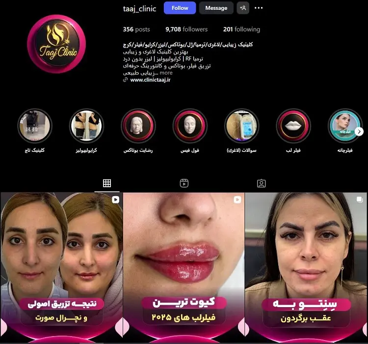 کلینیک تزریق ژل لب و زیبایی تاج کرج