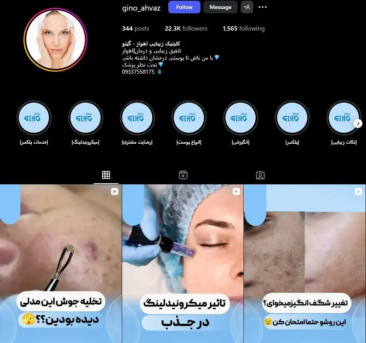 کلینیک تزریق ژل لب گینو اهواز