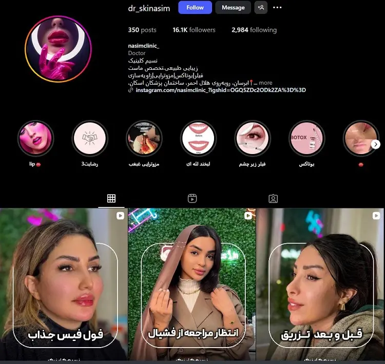 کلینیک تزریق ژل لب نسیم تبریز