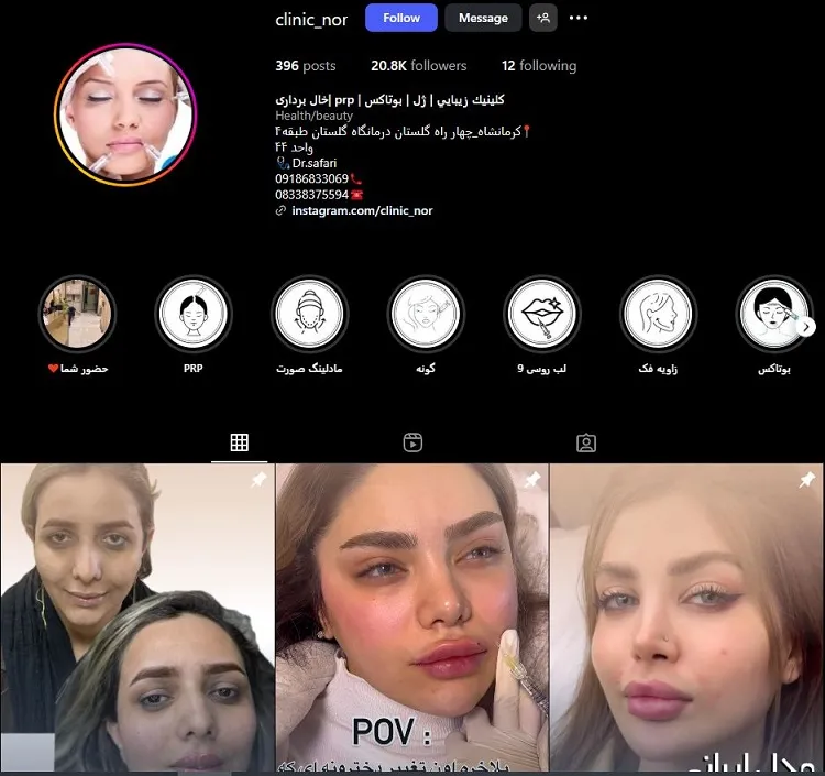 کلینیک بوتاکس در کرمانشاه، دکتر صفری