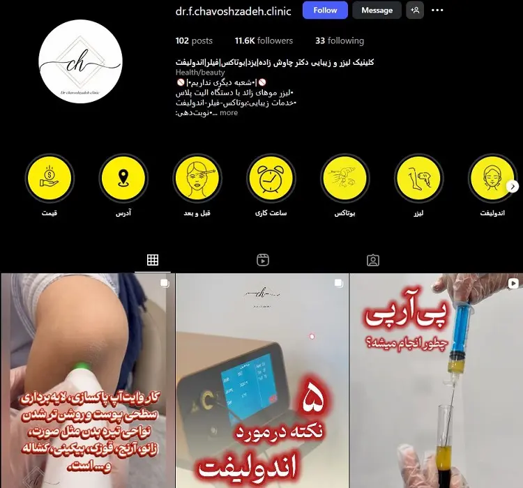 دکتر بوتاکس خانم چاوش زاده یزد