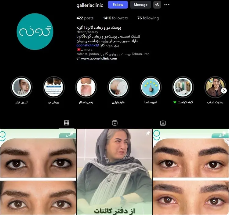 کلینیک تزریق بوتاکس گالریا