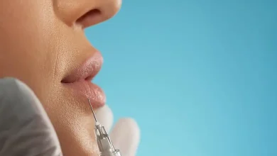 بهترین دکتر و کلینیک تزریق ژل لب در تبریز