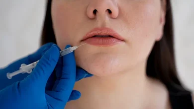 بهترین دکتر و کلینیک تزریق ژل لب در مشهد