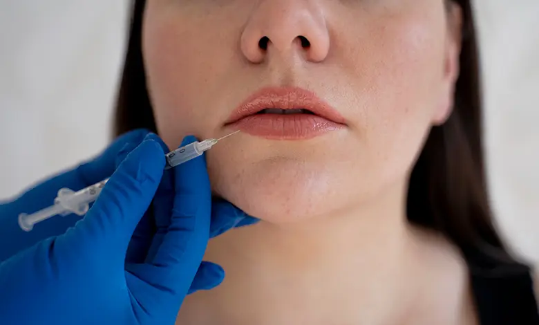 بهترین دکتر و کلینیک تزریق ژل لب در مشهد