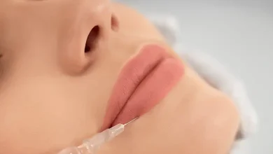 بهترین دکتر و کلینیک تزریق ژل لب در کرج