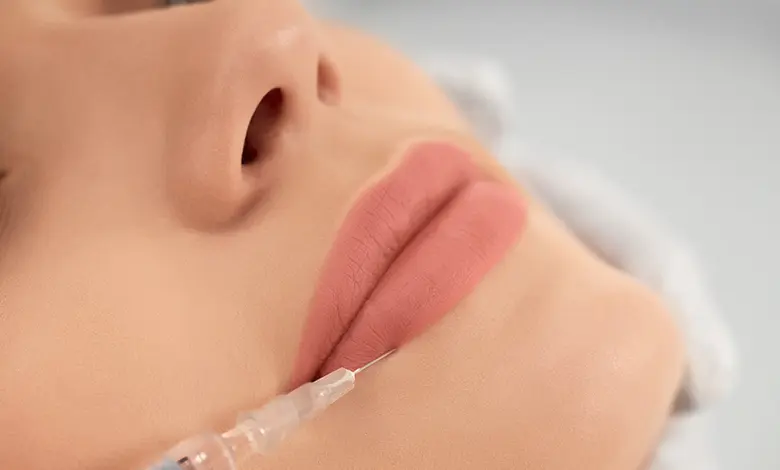 بهترین دکتر و کلینیک تزریق ژل لب در کرج