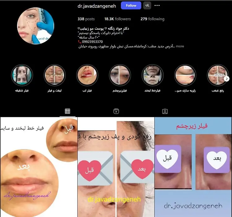 کلینیک زیبایی دکتر جواد زنگنه کرمانشاه