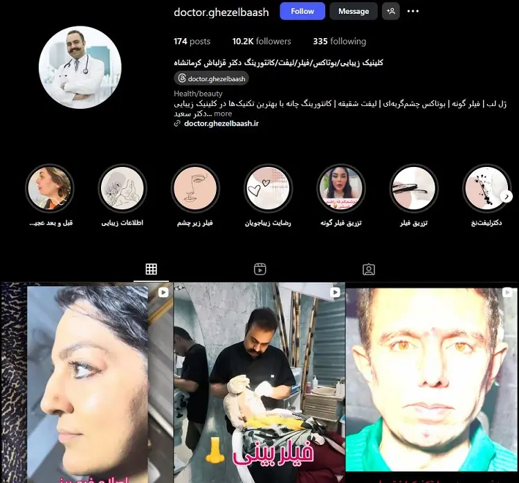 کلینیک زیبایی دکتر قزلباش کرمانشاه